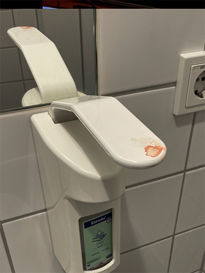 Wegen Feiertag muss ich mit meinem Ohr ins Krankenhaus...